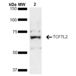 Western Blot - Anti-TCF-4 / TCF7L2 Antibody (A305158) - Antibodies.com