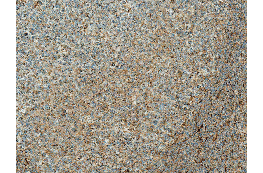 Immunohistochemistry - Anti-TCF-4 / TCF7L2 Antibody (A305158) - Antibodies.com