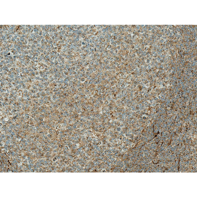 Immunohistochemistry - Anti-TCF-4 / TCF7L2 Antibody (A305158) - Antibodies.com