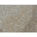 Immunohistochemistry - Anti-TCF-4 / TCF7L2 Antibody (A305158) - Antibodies.com