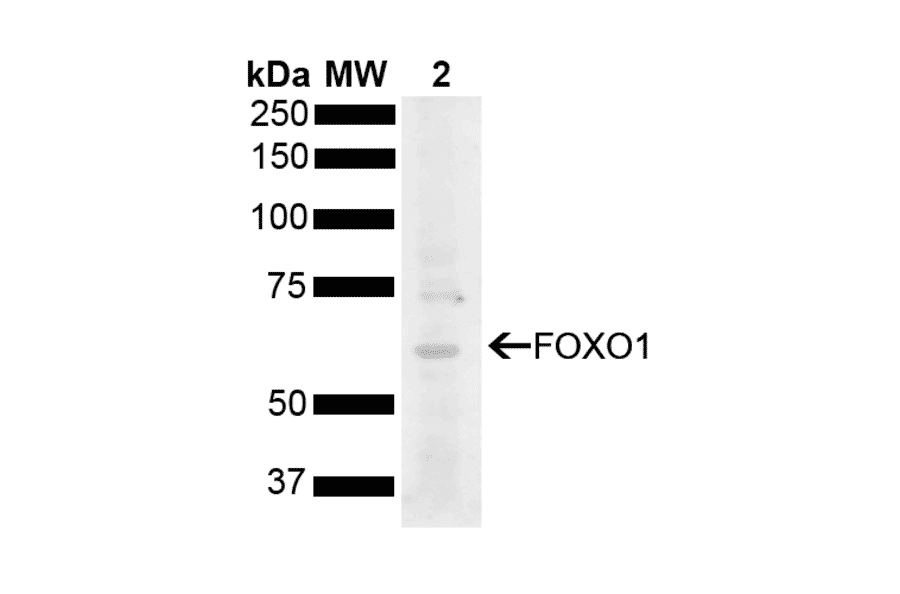 Western Blot - Anti-FOXO1A Antibody (A305159) - Antibodies.com
