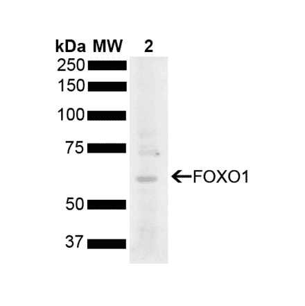 Western Blot - Anti-FOXO1A Antibody (A305159) - Antibodies.com