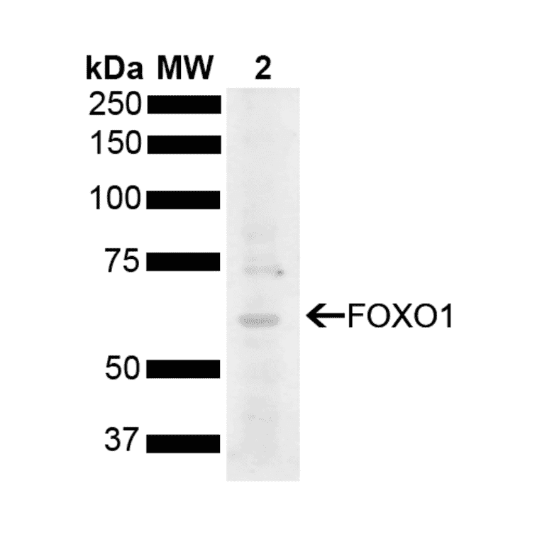 Western Blot - Anti-FOXO1A Antibody (A305159) - Antibodies.com