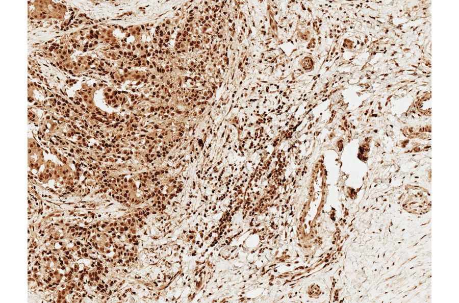 Immunohistochemistry - Anti-FOXO1A Antibody (A305159) - Antibodies.com
