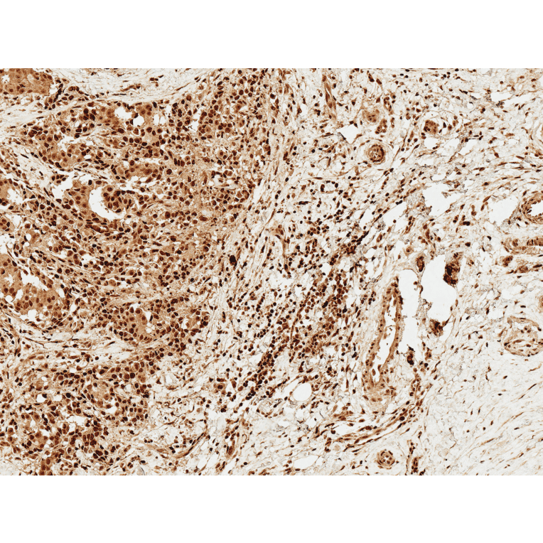 Immunohistochemistry - Anti-FOXO1A Antibody (A305159) - Antibodies.com