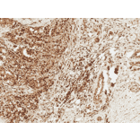 Immunohistochemistry - Anti-FOXO1A Antibody (A305159) - Antibodies.com