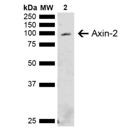 Western Blot - Anti-Axin 2 Antibody (A305160) - Antibodies.com