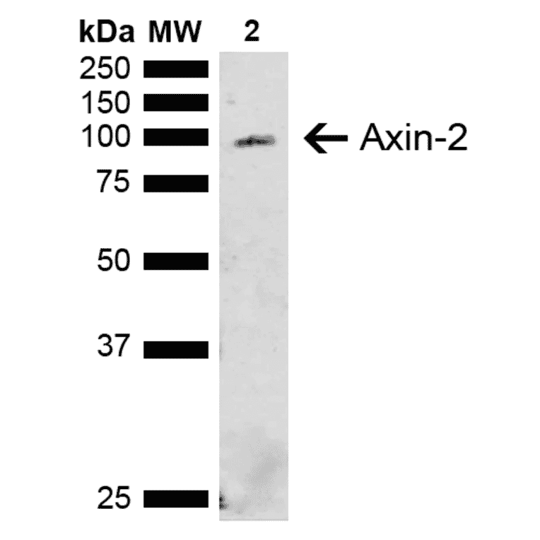 Western Blot - Anti-Axin 2 Antibody (A305160) - Antibodies.com