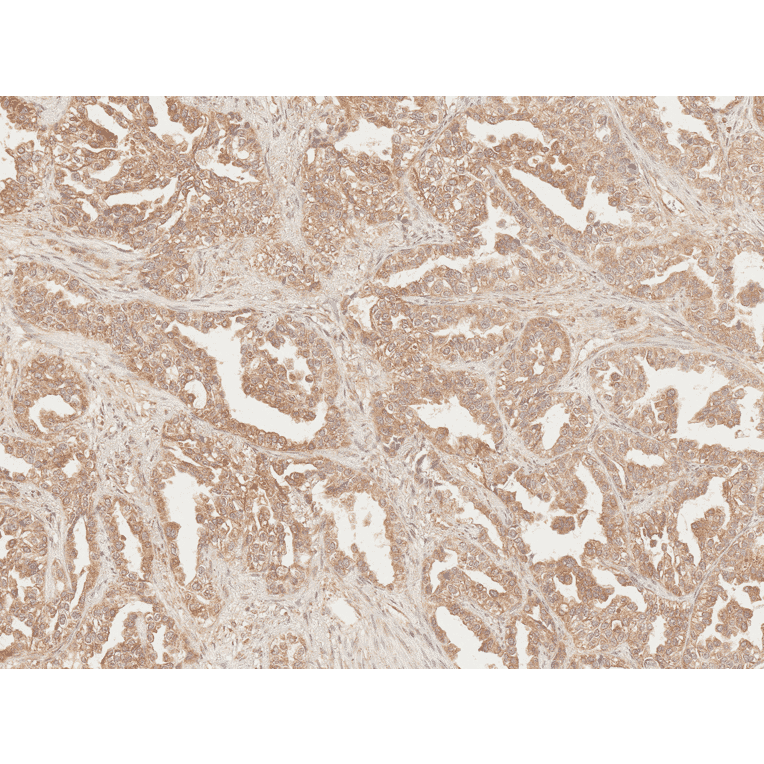 Immunohistochemistry - Anti-Axin 2 Antibody (A305160) - Antibodies.com