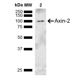 Western Blot - Anti-Axin 2 Antibody (A305161) - Antibodies.com