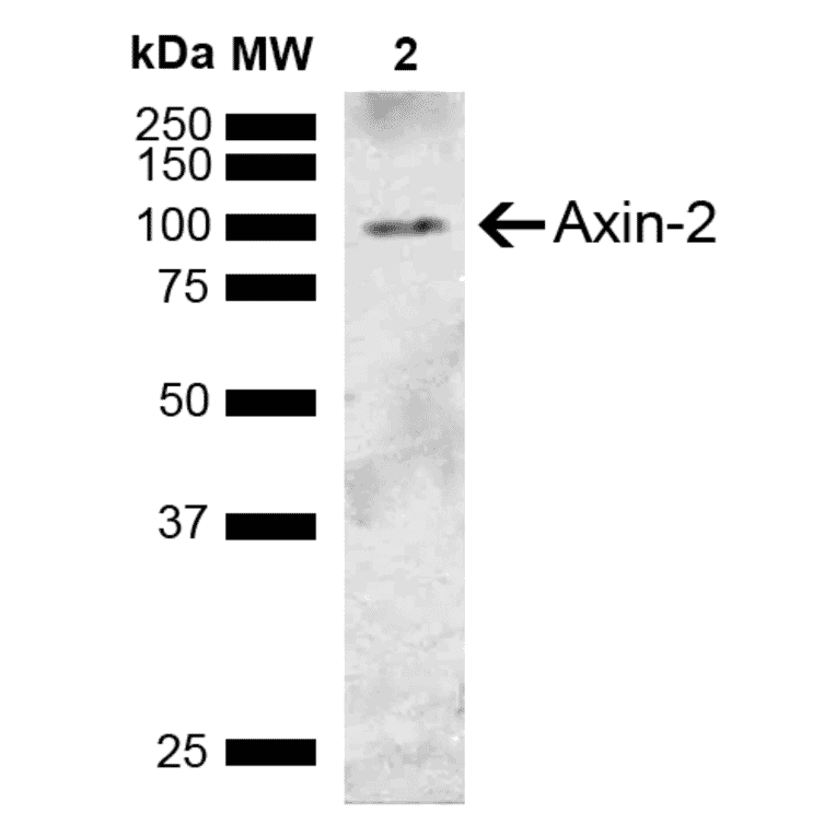 Western Blot - Anti-Axin 2 Antibody (A305161) - Antibodies.com