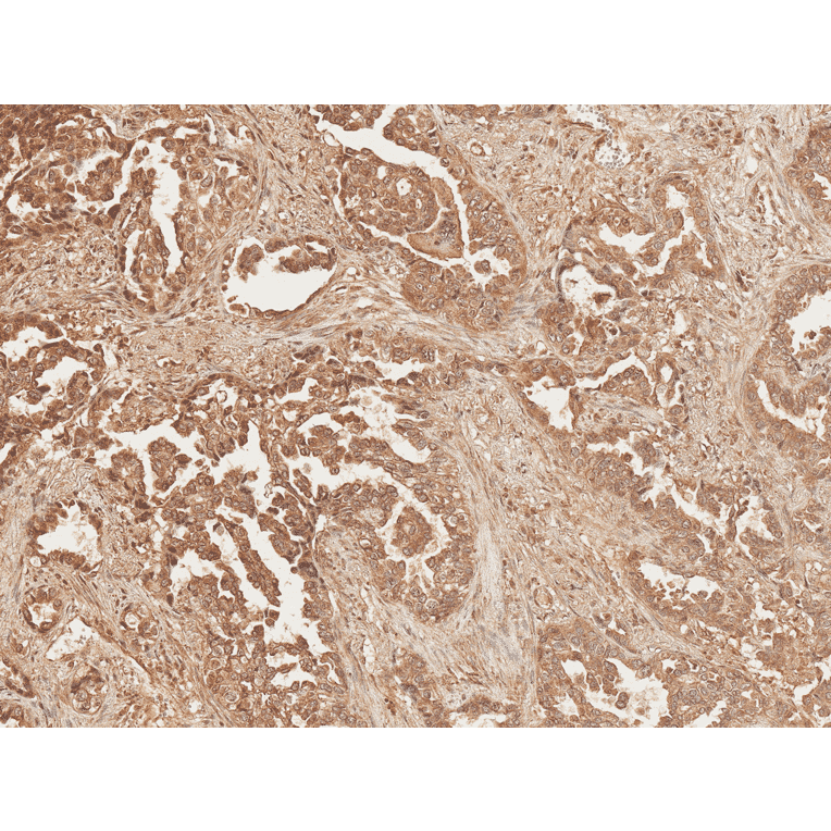 Immunohistochemistry - Anti-Axin 2 Antibody (A305161) - Antibodies.com