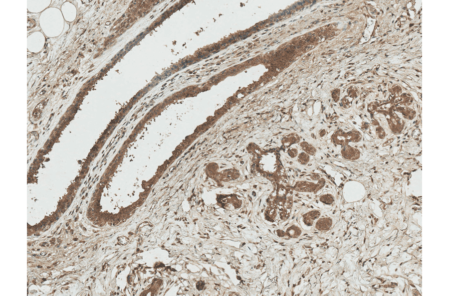 Immunohistochemistry - Anti-Axin 1 Antibody (A305162) - Antibodies.com