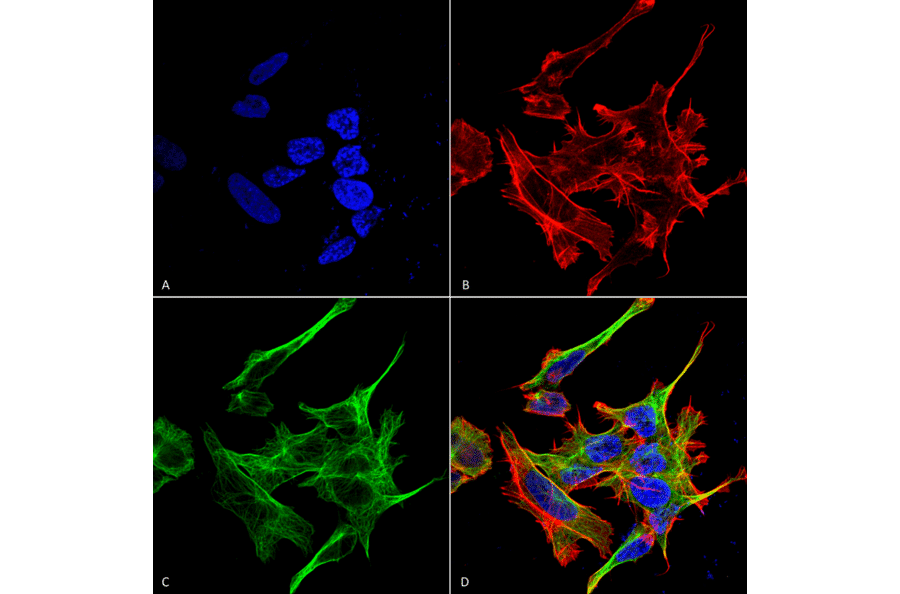 Immunocytochemistry/Immunofluorescence - Anti-GABARAPL1 Antibody (A305163) - Antibodies.com