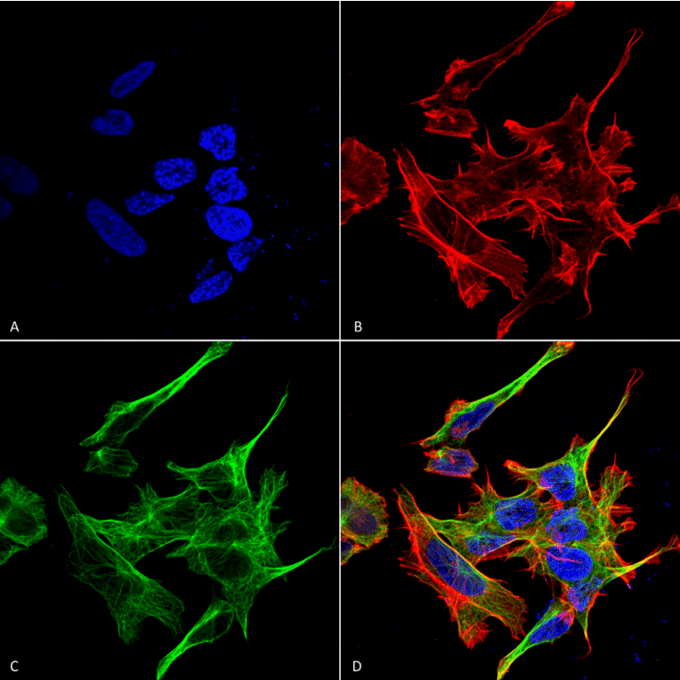 Immunocytochemistry/Immunofluorescence - Anti-GABARAPL1 Antibody (A305163) - Antibodies.com