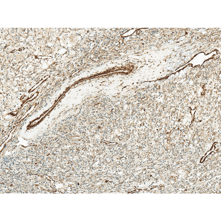 Immunohistochemistry - Anti-Kir4.1 Antibody (A305164) - Antibodies.com