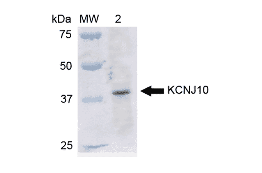 Western Blot - Anti-Kir4.1 Antibody (A305164) - Antibodies.com