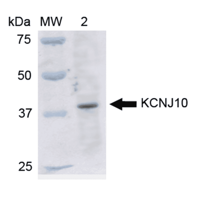 Western Blot - Anti-Kir4.1 Antibody (A305164) - Antibodies.com