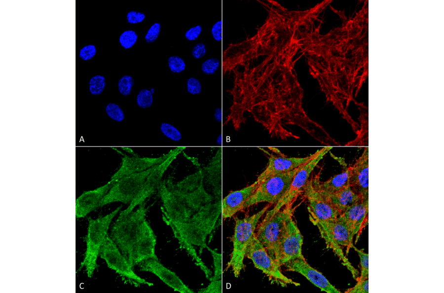Immunocytochemistry/Immunofluorescence - Anti-Kir4.1 Antibody (A305164) - Antibodies.com
