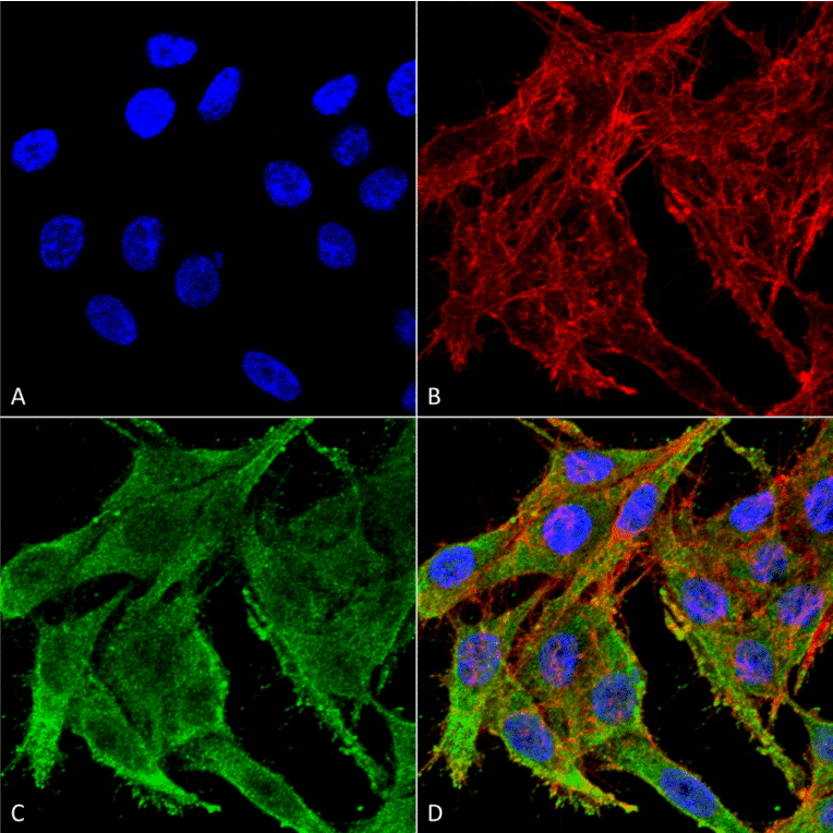 Immunocytochemistry/Immunofluorescence - Anti-Kir4.1 Antibody (A305164) - Antibodies.com