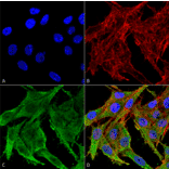 Immunocytochemistry/Immunofluorescence - Anti-Kir4.1 Antibody (A305164) - Antibodies.com