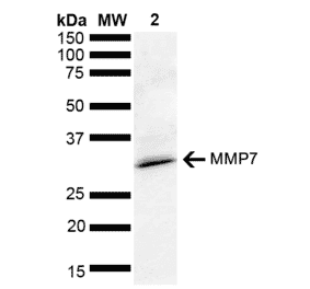 Western Blot - Anti-MMP7 Antibody (A305165) - Antibodies.com