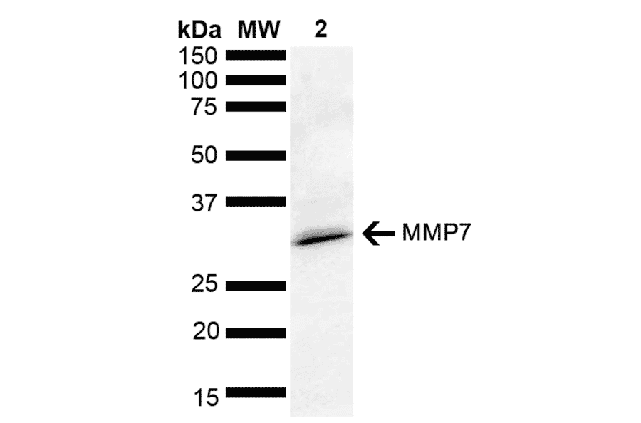 Western Blot - Anti-MMP7 Antibody (A305165) - Antibodies.com