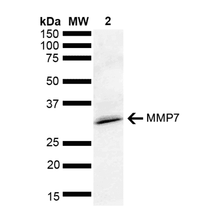 Western Blot - Anti-MMP7 Antibody (A305165) - Antibodies.com