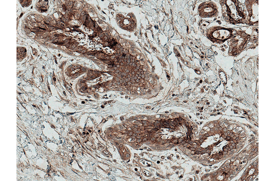 Immunohistochemistry - Anti-MMP7 Antibody (A305165) - Antibodies.com