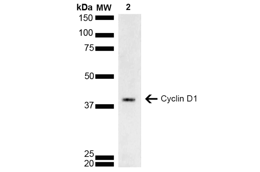 Western Blot - Anti-Cyclin D1 Antibody (A305166) - Antibodies.com
