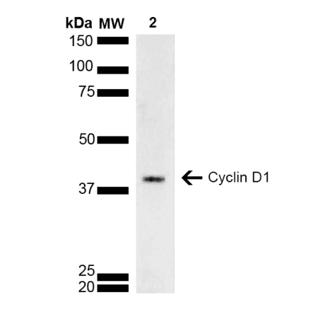 Western Blot - Anti-Cyclin D1 Antibody (A305166) - Antibodies.com