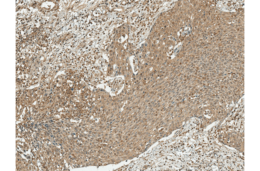 Immunohistochemistry - Anti-Cyclin D1 Antibody (A305166) - Antibodies.com