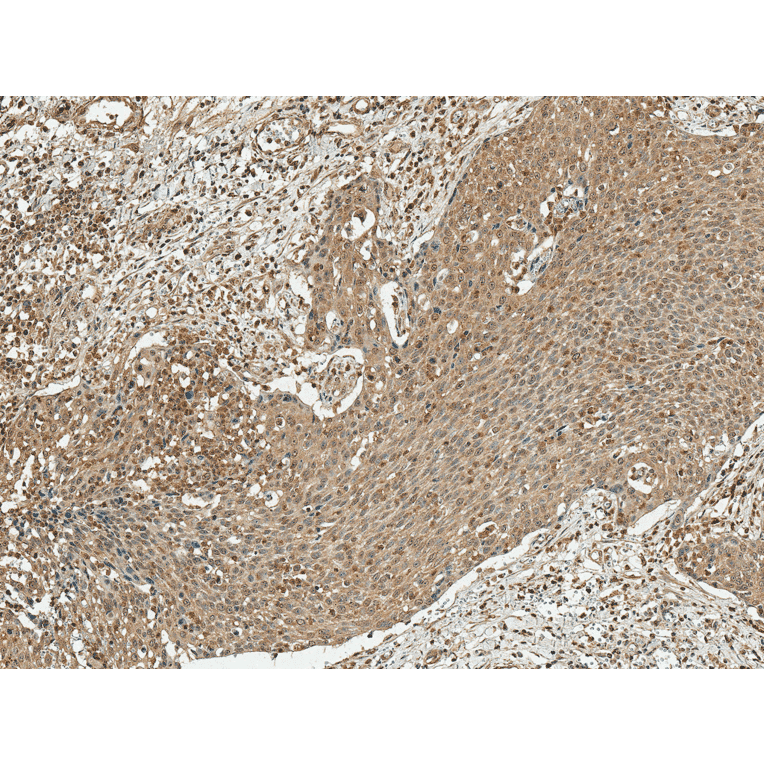 Immunohistochemistry - Anti-Cyclin D1 Antibody (A305166) - Antibodies.com