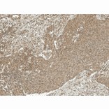 Immunohistochemistry - Anti-Cyclin D1 Antibody (A305166) - Antibodies.com