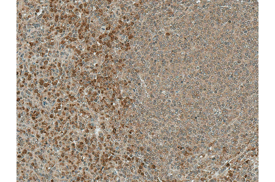 Immunohistochemistry - Anti-NFATC1 Antibody (A305167) - Antibodies.com