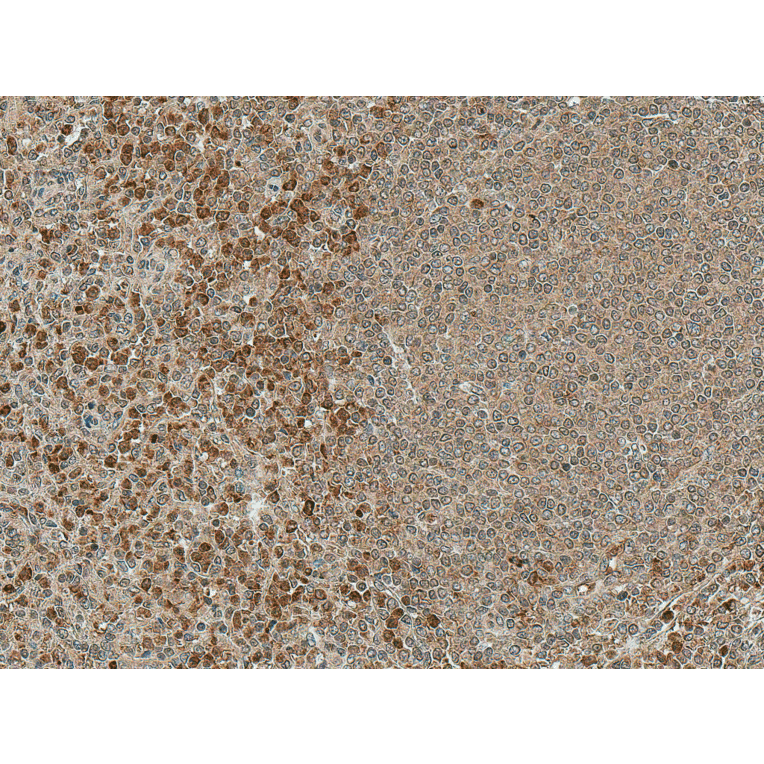 Immunohistochemistry - Anti-NFATC1 Antibody (A305167) - Antibodies.com