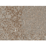 Immunohistochemistry - Anti-NFATC1 Antibody (A305167) - Antibodies.com