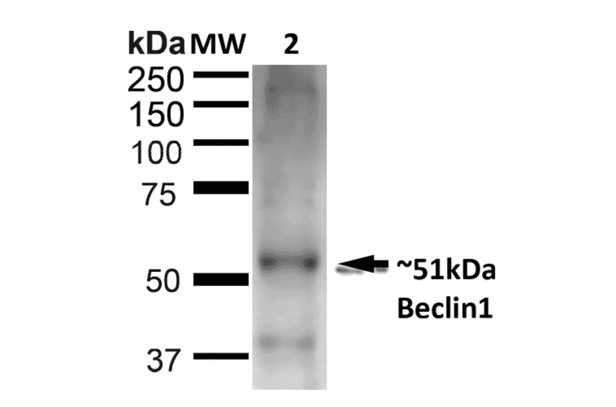 Western Blot - Anti-Beclin 1 Antibody (A305168) - Antibodies.com