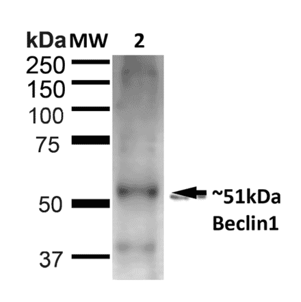 Western Blot - Anti-Beclin 1 Antibody (A305168) - Antibodies.com