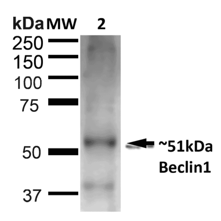 Western Blot - Anti-Beclin 1 Antibody (A305168) - Antibodies.com