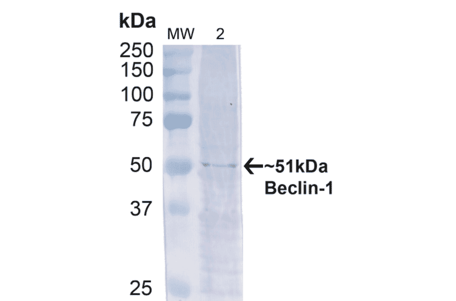 Western Blot - Anti-Beclin 1 Antibody (A305168) - Antibodies.com
