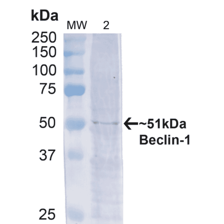 Western Blot - Anti-Beclin 1 Antibody (A305168) - Antibodies.com