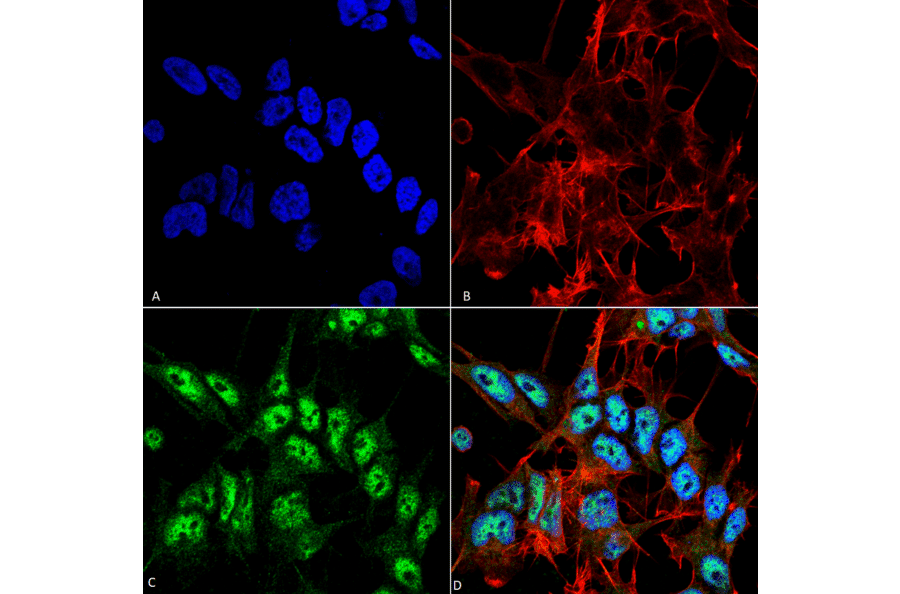 Immunocytochemistry/Immunofluorescence - Anti-Beclin 1 Antibody (A305168) - Antibodies.com