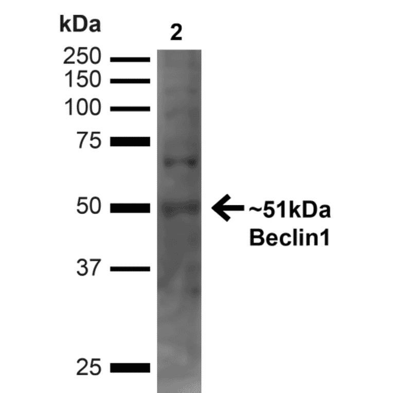 Western Blot - Anti-Beclin 1 Antibody (A305169) - Antibodies.com
