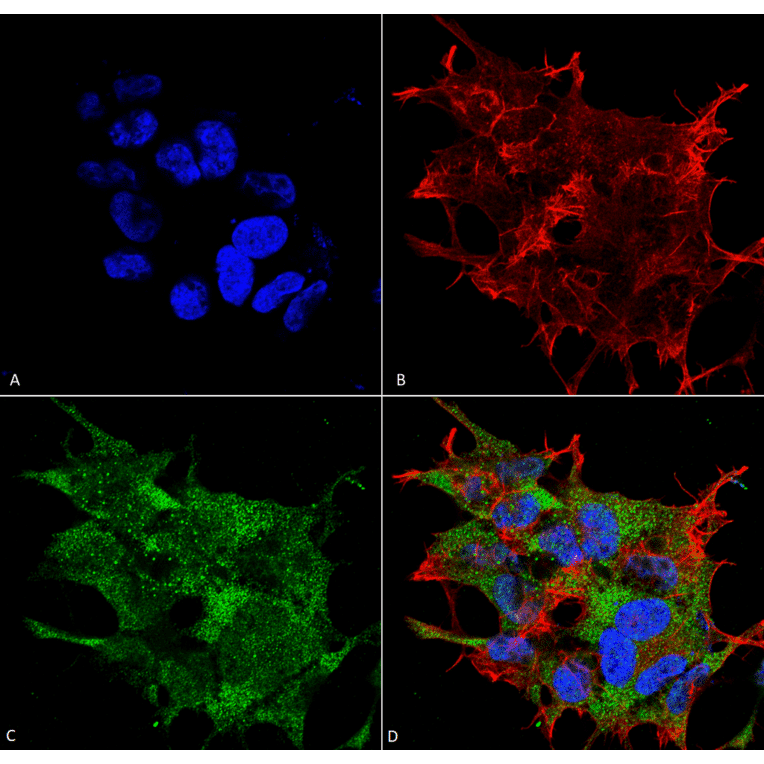 Immunocytochemistry/Immunofluorescence - Anti-Beclin 1 Antibody (A305169) - Antibodies.com