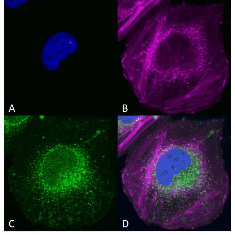 Immunocytochemistry/Immunofluorescence - Anti-Beclin 1 Antibody (A305169) - Antibodies.com