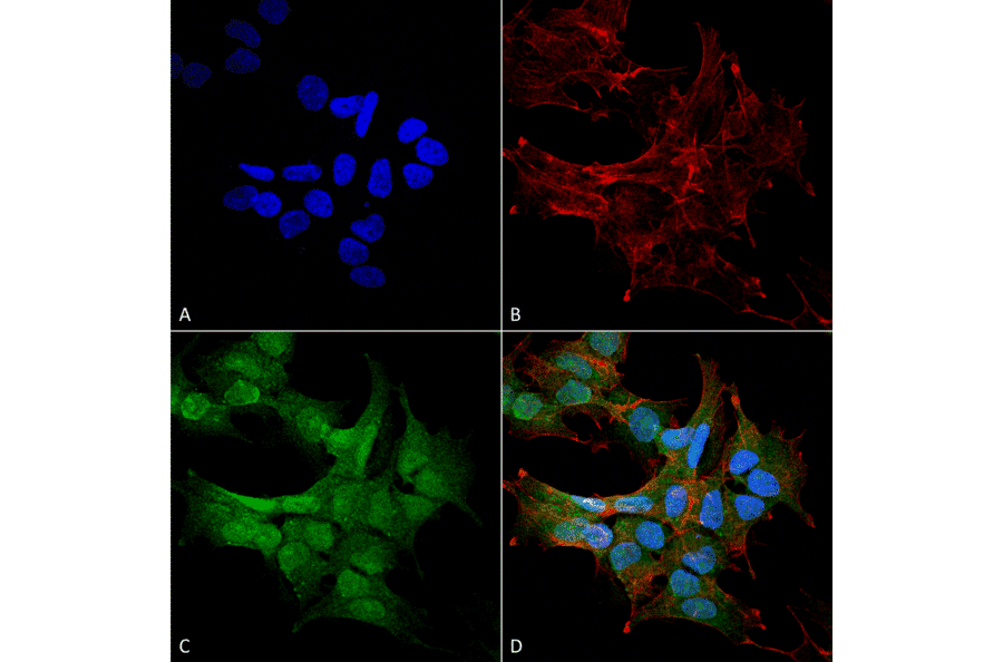 Immunocytochemistry/Immunofluorescence - Anti-Beclin 2 Antibody (A305170) - Antibodies.com