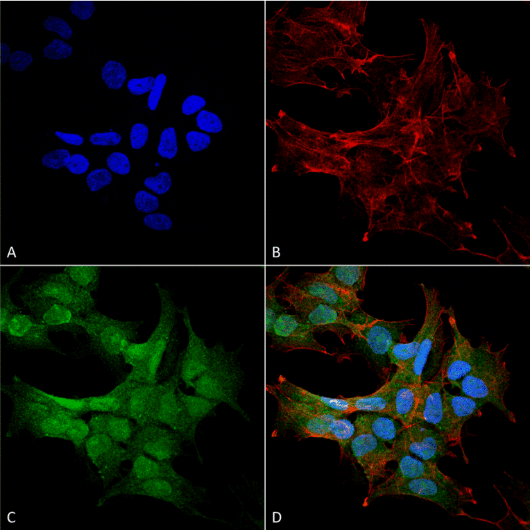 Immunocytochemistry/Immunofluorescence - Anti-Beclin 2 Antibody (A305170) - Antibodies.com