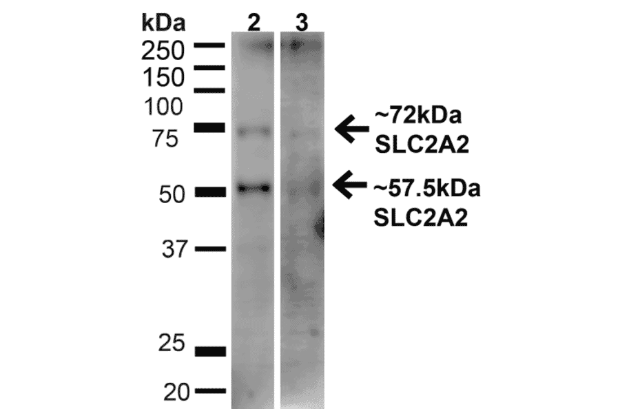 Western Blot - Anti-GLUT2 Antibody (A305171) - Antibodies.com