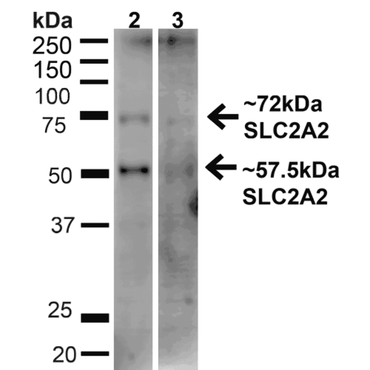 Western Blot - Anti-GLUT2 Antibody (A305171) - Antibodies.com